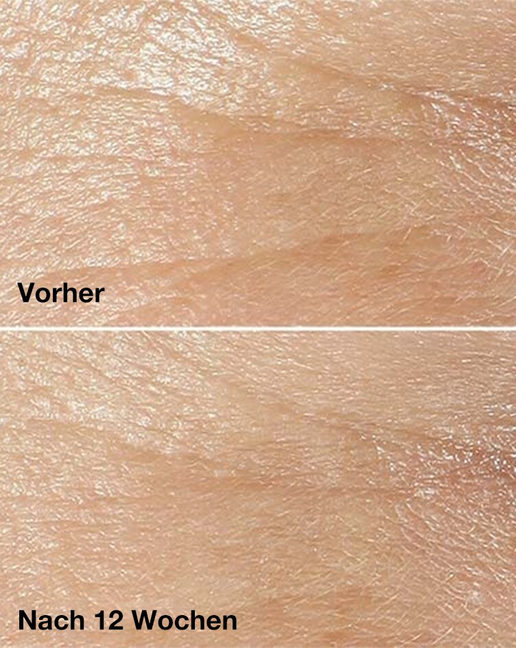 Vorher. Nach 12 Wochen.